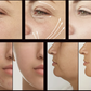 Électrothérapie haute fréquence AltheaFrequency™